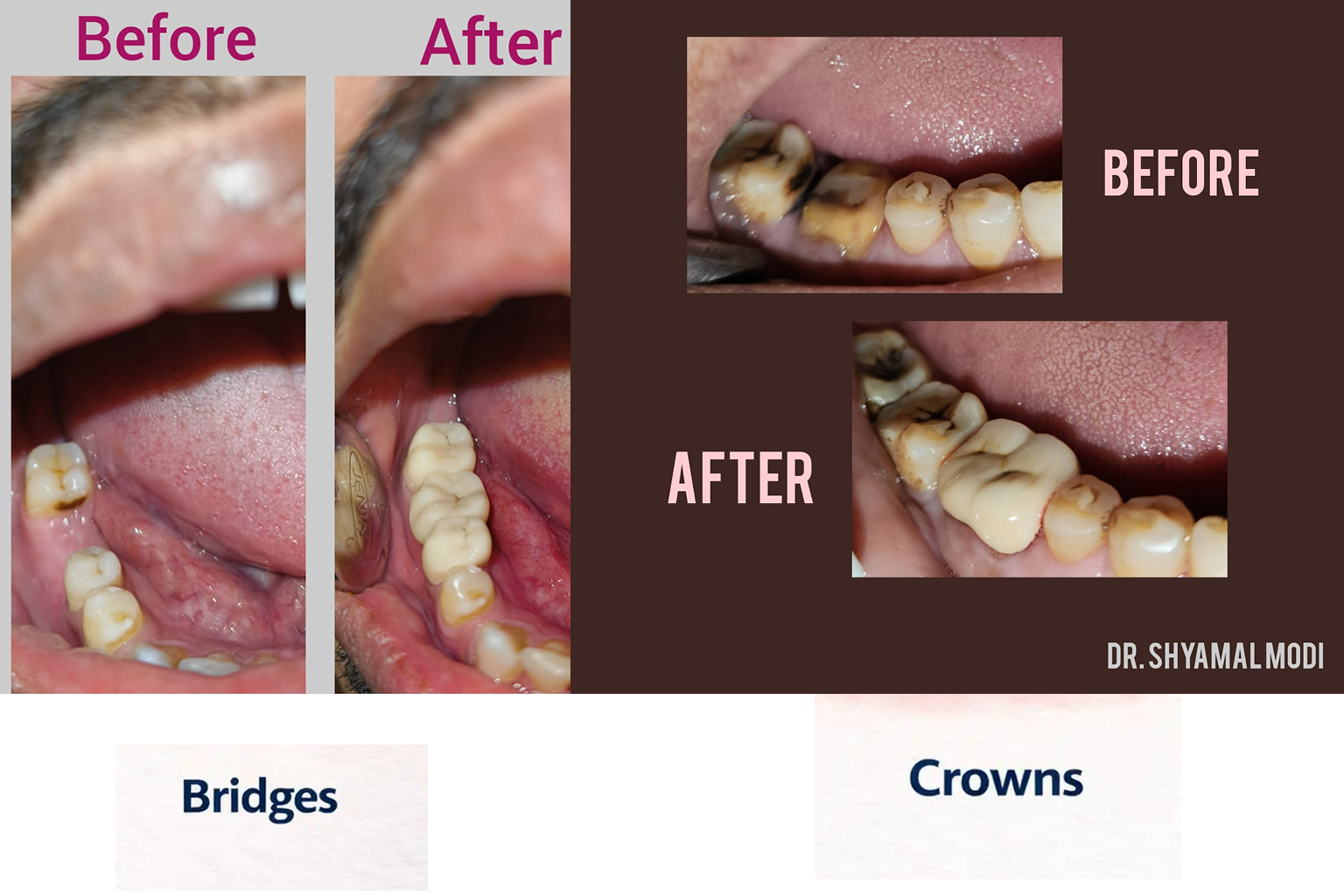 Restorative Dentistry