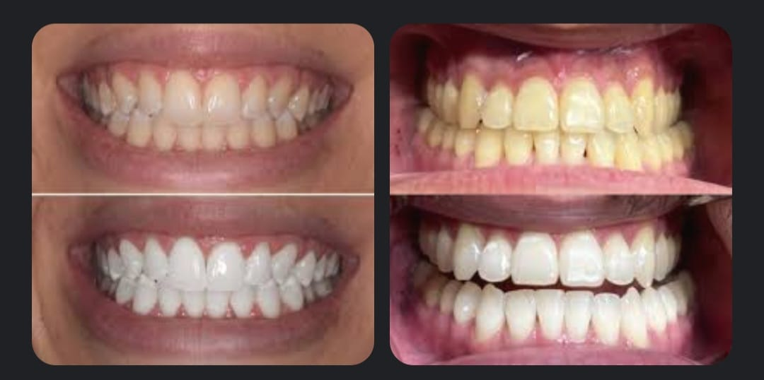 Cosmetic Dentistry