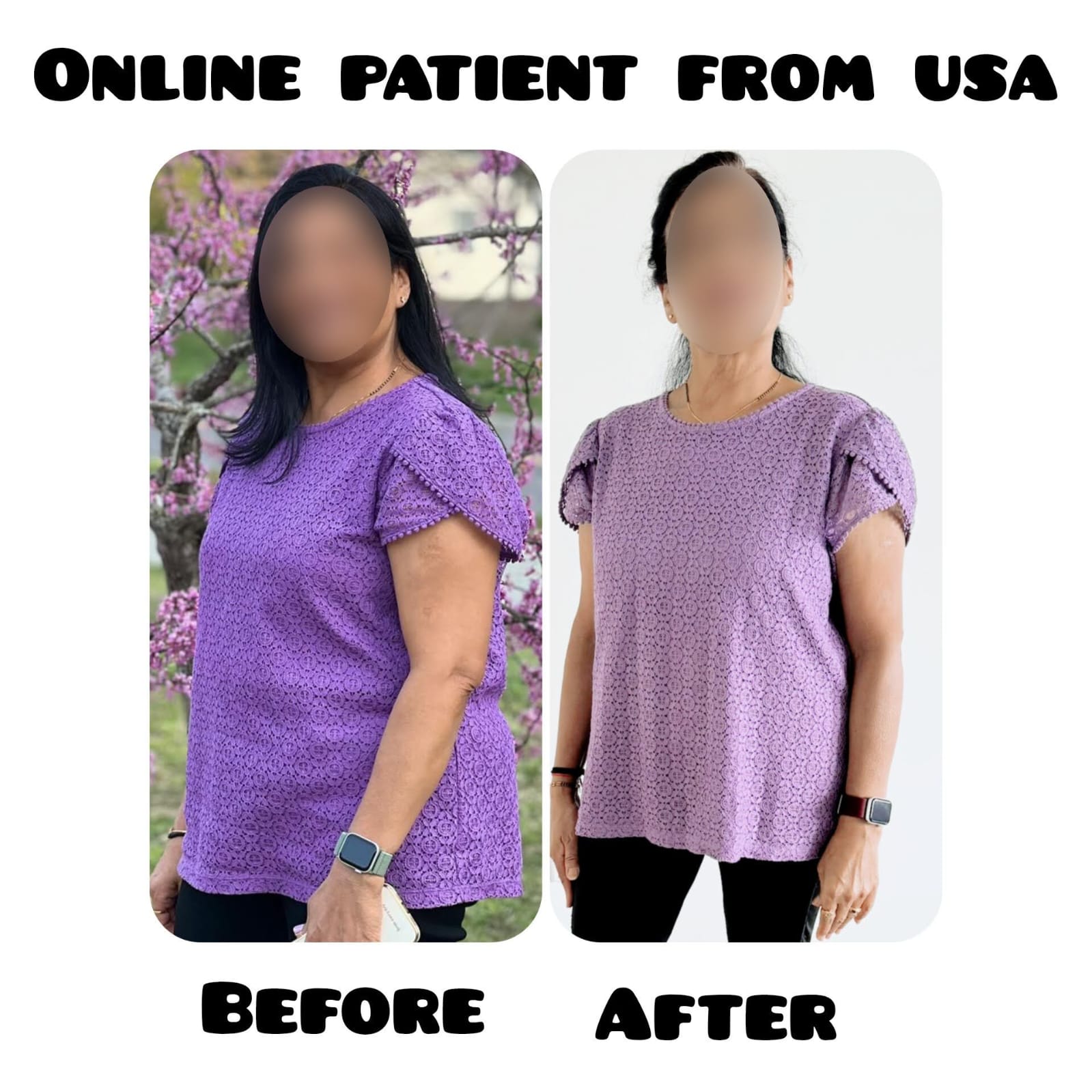 Weight Loss Progress